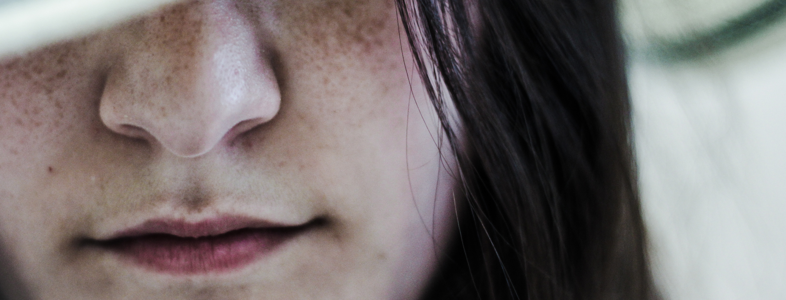 crema schiarente macchie farmacia per macchie solari acne cicatrici farmacia bologna