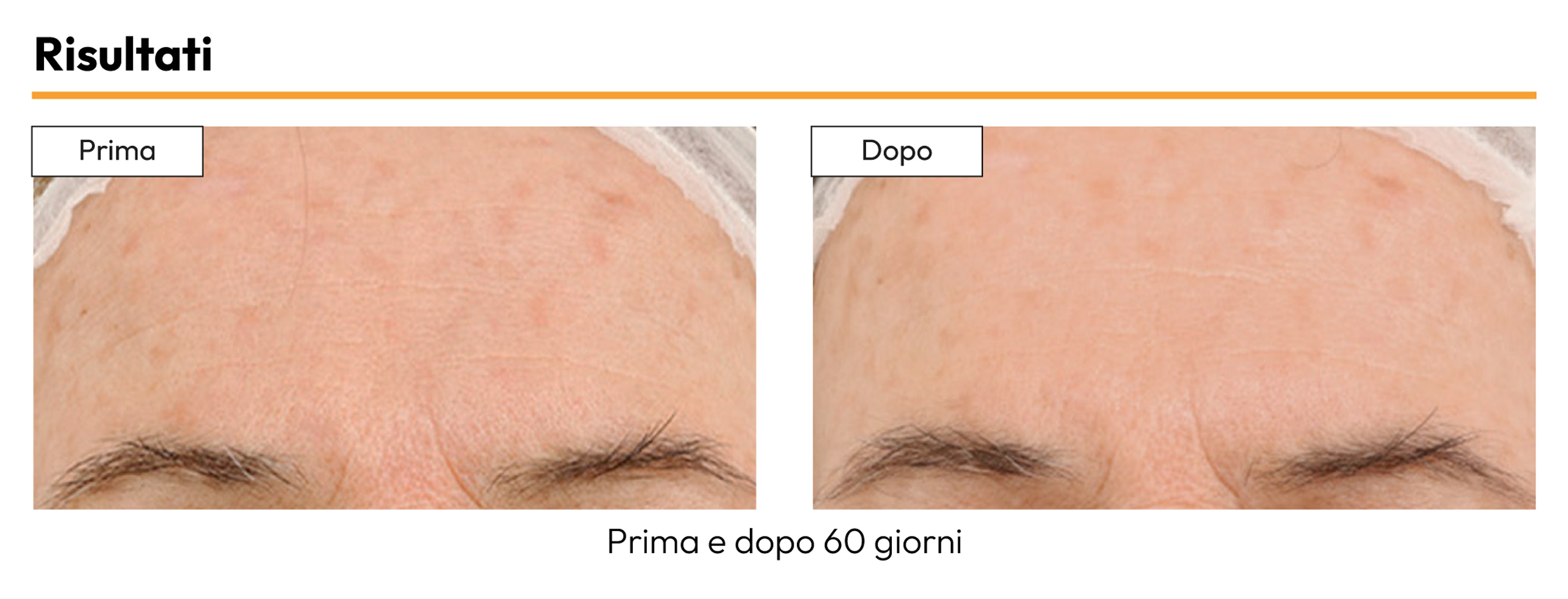 Chromabright: crema e siero depigmentante per il trattamento delle macchie sul viso