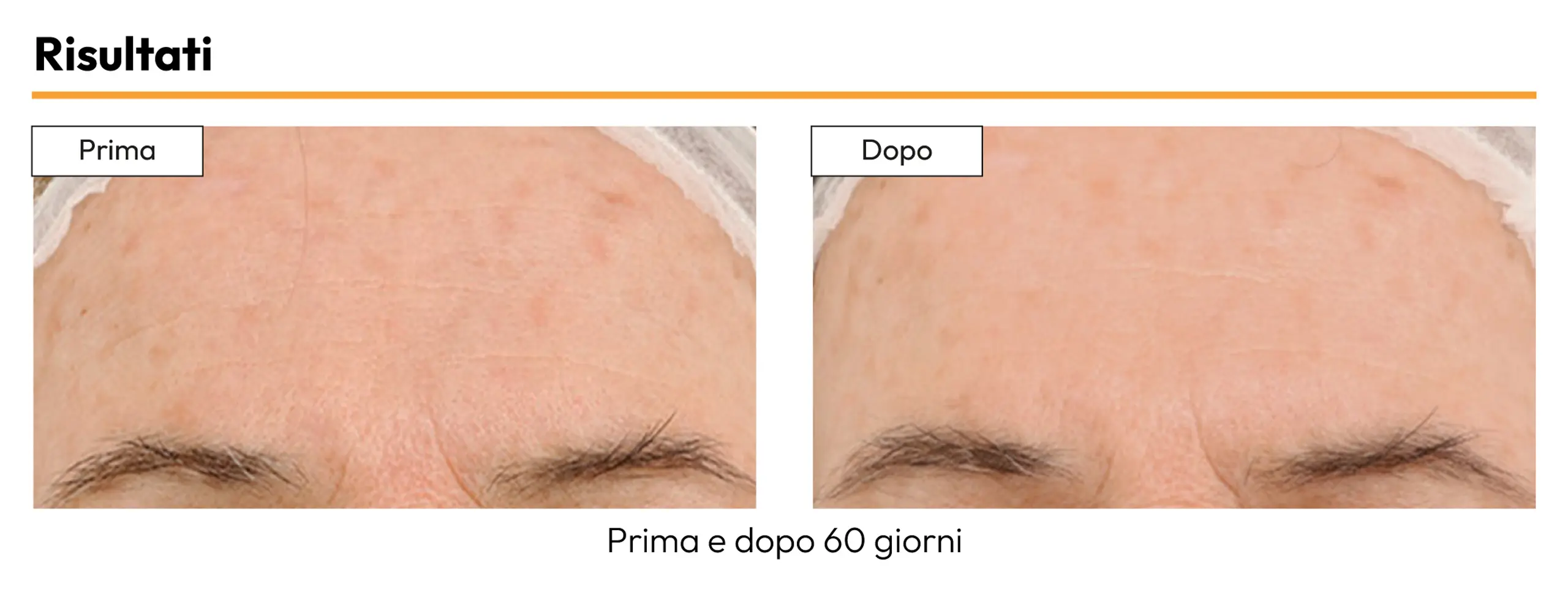 Chromabright: crema e siero depigmentante per il trattamento delle macchie sul viso