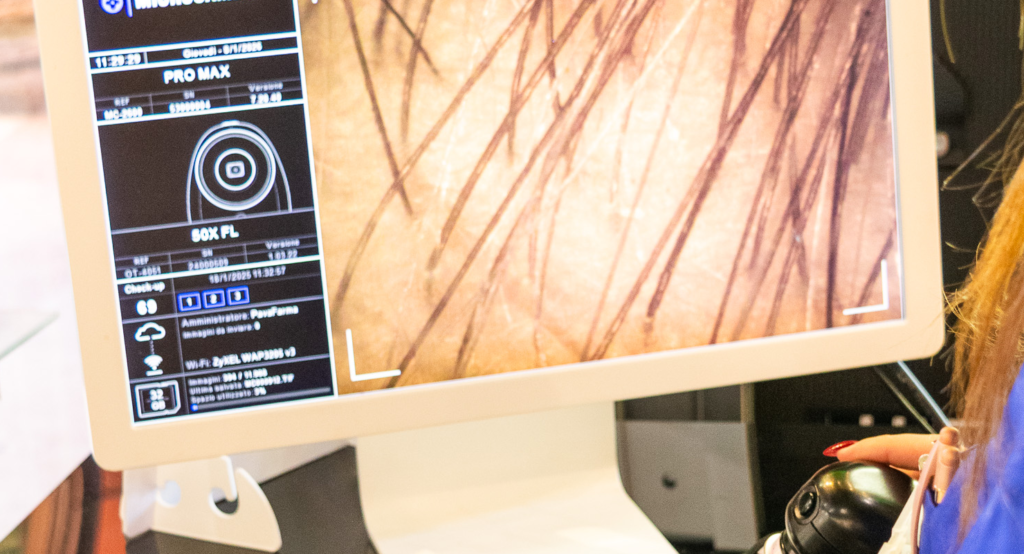 Analisi della pelle gratuita e del capello con microcamera professionale in farmacia a Bologna