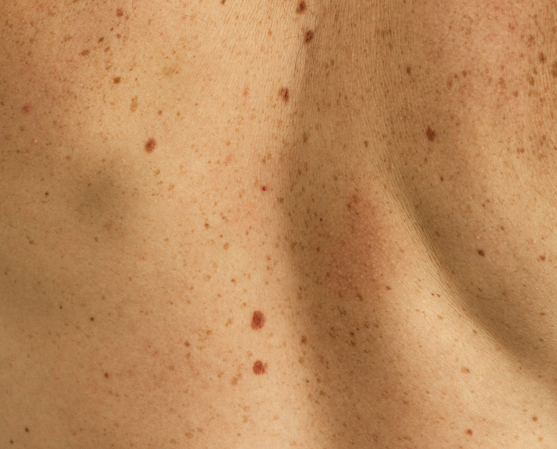 Teledermatologia Bologna farmacia consulenza dermatologica a distanza