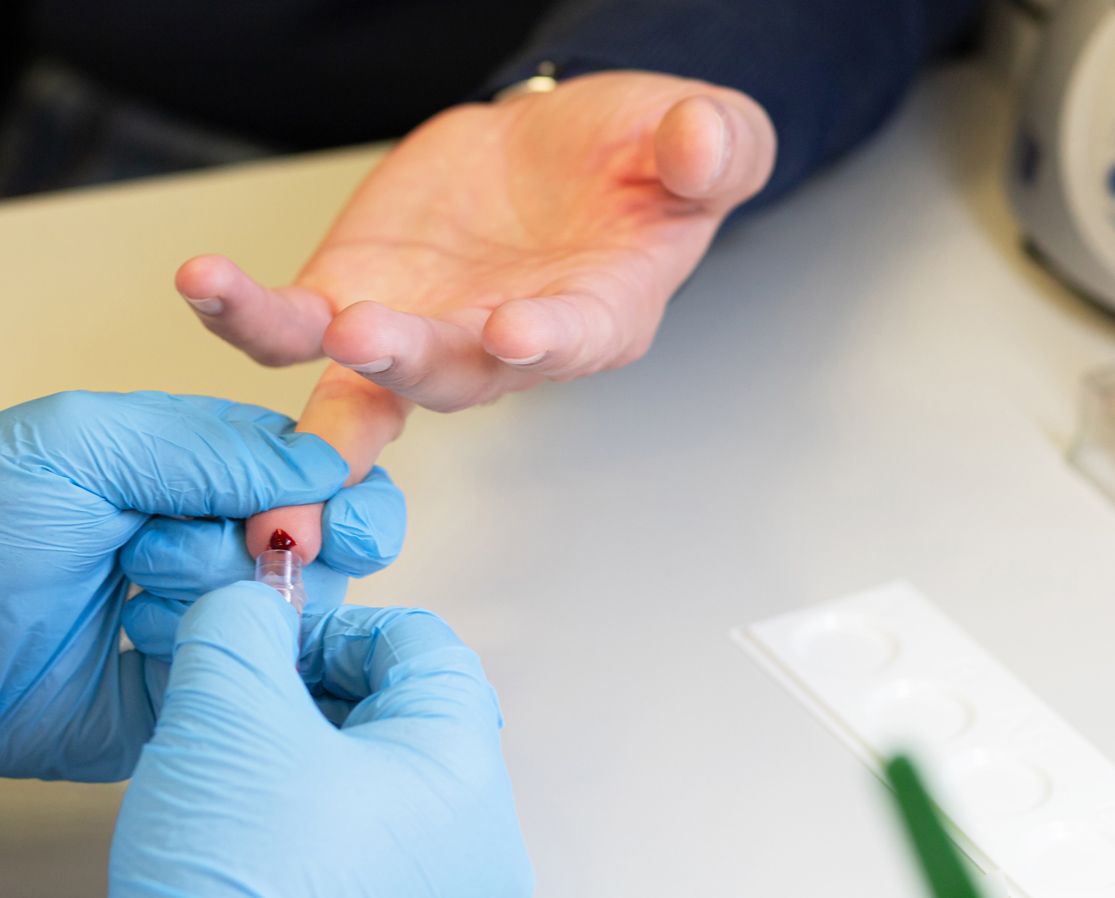 Farmacia Bologna misurazione colesterolo totale, HDL, LDL e trigliceridi