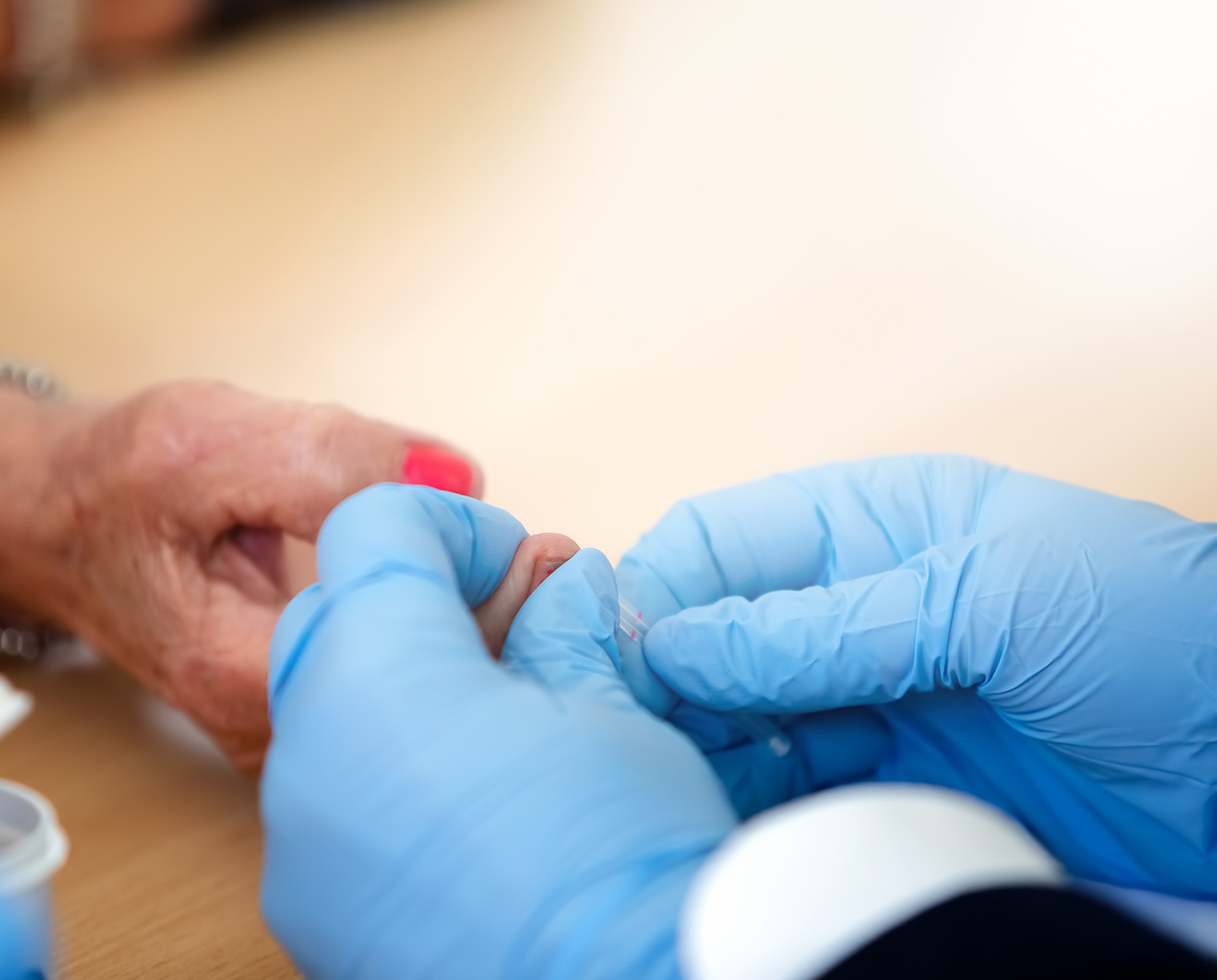 misurazione della PCR (Proteina C Reattiva) farmacia bologna