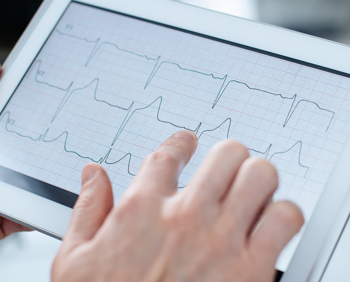 Farmacia Bologna ECG elettrocardiogramma